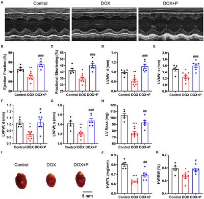 Periplocymarin Alleviates Doxorubicin-Induced Heart Failure and Excessive Accumulation of Ceramides